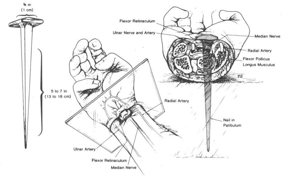 medical type drawing of the details of having a nail driven through your hand