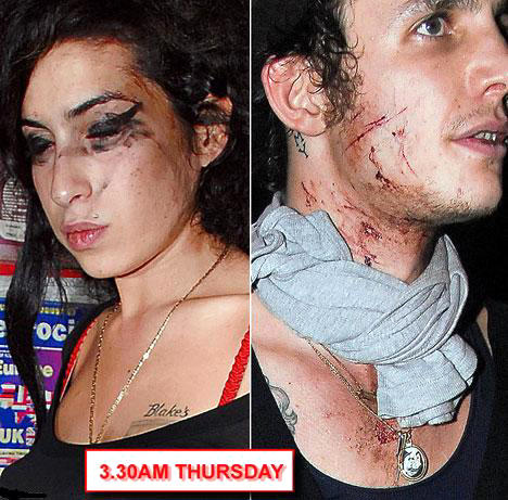 Amy Winehouse and her man Blake Fielder-Civil having a rough day